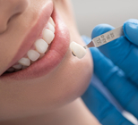 כתר זירקוניה: חזק, עמיד ושומר על החניכיים-תמונה